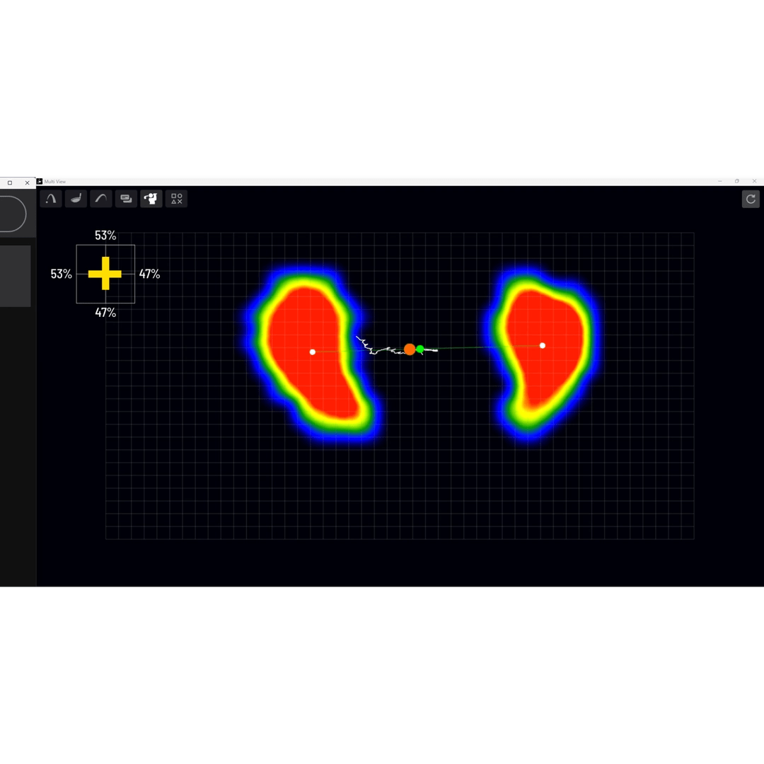 Uneekor Performance Optix Bundle